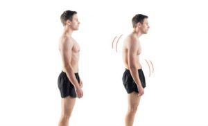 How Long Does It Take To Fix Rounded Shoulders