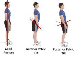 different types of poor posture