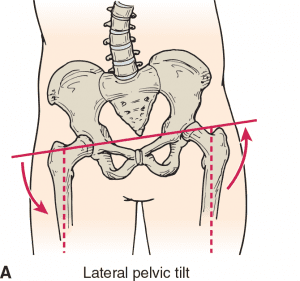 lateral pelvic tilt exercises