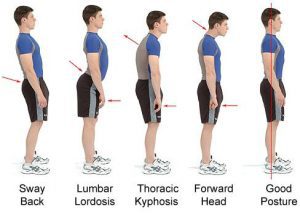 How Long do You Have to Wear a Posture Corrector