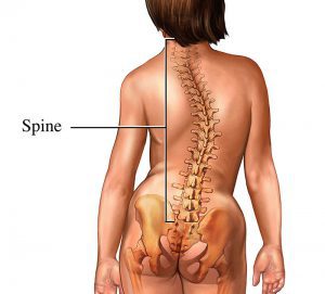 how to improve posture with scoliosis